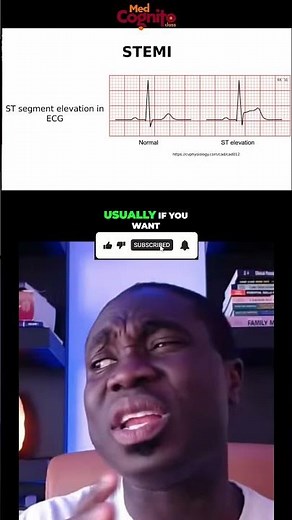 STEMI vs NSTEMI ECG: Tombstoning and ST Elevation Explained #shorts