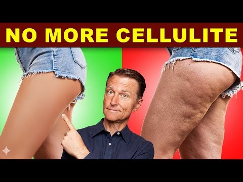 Fastest Natural Method to Smooth Cellulite | Beauty & Wellness