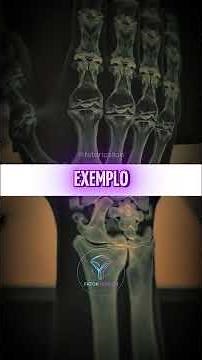 Como Funcionam os Raios X e Sua Importância para a Saúde