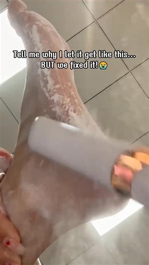 Honeyyyyy, do yall see the aftermath of this electric foot file😳 ✨ Say goodbye to rough heels! The automatic electric foot grinder is here! 🦶 Easily remove dead skin and calluses, giving your feet a soft and comfortable feel. 💧 Home use design, simple and safe, enjoy professional-level repair. 🛍️ Click here to get it, and make your steps light and confident!👇 | Nidfbuy.HK