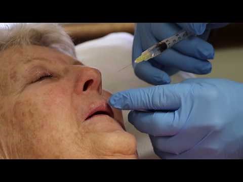 Punch Biopsy on the Upper Lip | Basal Cell Carncinoma