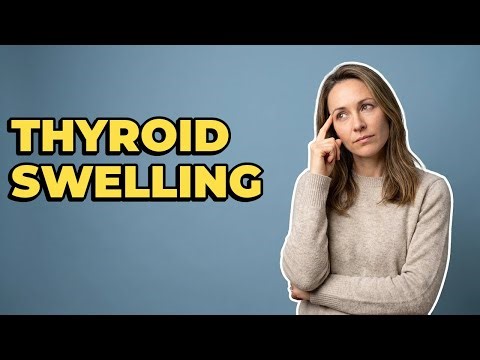 What Exactly Is a Goiter on Your Thyroid?