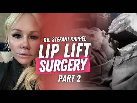EVERYTHING I DID BEFORE MY LIP LIFT + Watch My Procedure & Day One Recovery