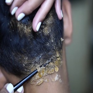 26K views · 128 reactions | toktok tv show dandruff removal on head...