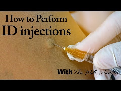 How to Perform ID Injections!