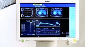 Electrical impedance tomography (EIT) is one stratetgy to assess lung recruitability in #COVID19 patients. EIT offers continuous and non-invasive monitoring at the bedside. Find out more: | Dräger