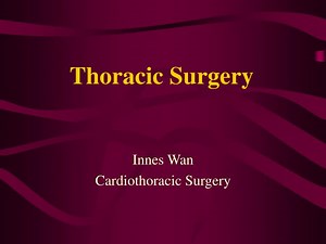 Thoracic Surgery - SlideServe
