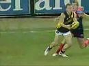 AFL Player Nathan Brown Breaks Leg