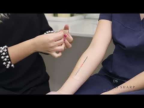 How to apply and remove silicone tape after plastic surgery