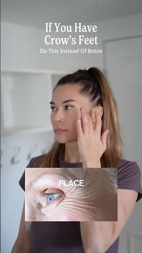 Get rid of crows feet naturally without Botox