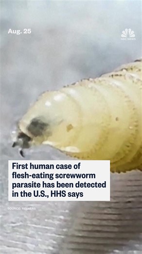 210K views · 1.1K reactions | The first human case of the flesh-eating parasite "New World screwworm" has been detected in the United States, the Department of Health and Human Services said Monday. | NBC News | Facebook