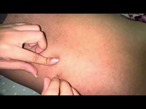 ASMR Gentle Back Scratch👌🏻Sent Me Into Deep ASMR Sleep Tingling Video☘️💤😴 #asmr #backscratching