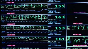 Overall Nurses Station Monitor Neonatal Intensive Stock Footage Video (100% Royalty-free) 8269384 | Shutterstock