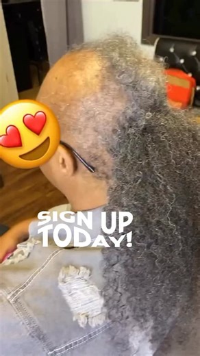 253 reactions · 13 comments |   Become a Certified Alopecia...