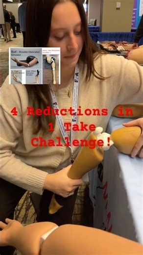 Shoulder, Elbow, Finger and Hip Dislocations : what to do? #orthopedic #shoulderdislocation