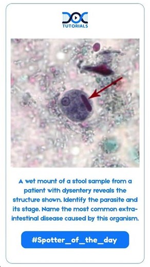 Spotter of the Day | DocTutorials MBBS