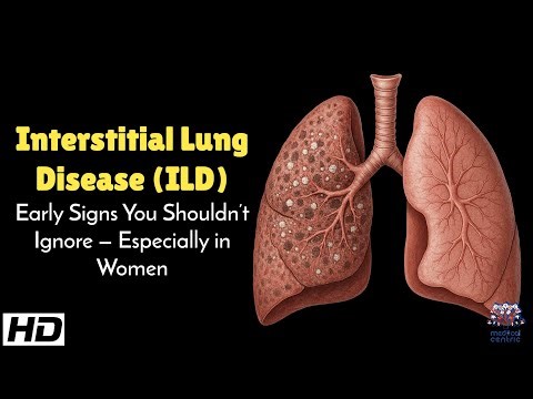 Interstitial Lung Disease (ILD) Early Signs You Shouldn’t Ignore : Especially in Women