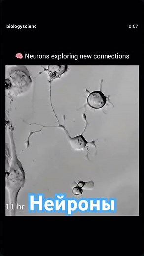Так нейроны создают новые нейронные связи! Физиология под микроскопом #физиология #анатомия