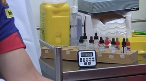 5K views · 40 reactions | Skin Prick Test (Allergy Test) | Medical Students | Facebook