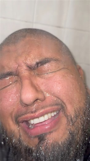 63K views · 757 reactions | When a Man gets a Colonoscopy 凉 #LifeOfPablo #Alpllc #Colonoscopy #Atl #over40club #ColonHealth | Life Of Pablo | Facebook