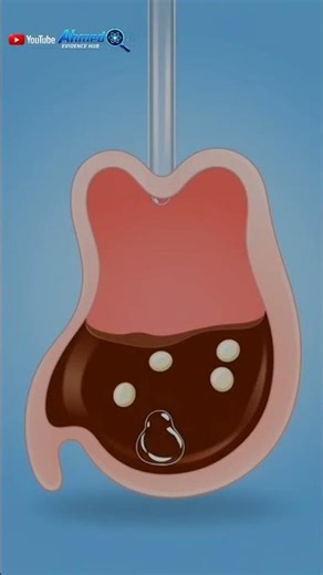 “Will Coke + Mentos Explode Your Stomach? Myth vs Chemistry”#MythVsFact #ScienceShorts #CokeMentos #