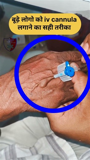 Trick for inserting an IV cannula || #nursing #skills #doctor #trick #cannula ‪@robothealth‬