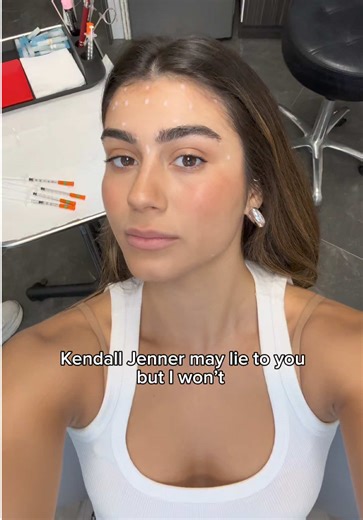 Dysport Treatment Insights with Samantha The Beauty NP