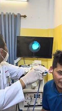 😳 The Earwax Just Kept Coming Out! #earwax #earcare #shorts