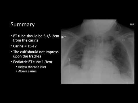 Endotracheal Tubes