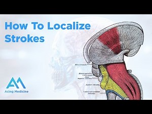 How To Localize Strokes: Essential Overview & Techniques | Acing Medicine