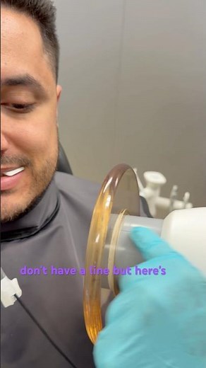 How to take bitewings with a NOMAD #dentalhygiene #dentist #dentalassistant #dentalhygienestudent
