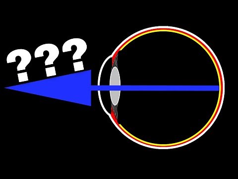 What is the Red Reflex?