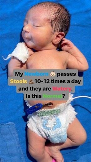 Dr Puneet Anand | Pediatrician & Parenting Expert on Instagram: "A Newborn Baby should pass its first stool (greenish black & tarry) within 24 hours after birth which is known as meconium. 🧑🏻‍⚕️On the 3rd or 4th day, the stool frequency increases and are semi loose and greenish-yellow in colour which settles in the next 1-2 days. 🧑🏻‍⚕️By the 5th-7th day, babies who are breastfed usually pass frequent golden-yellow, semiloose sticky stools. 🧑🏻‍⚕️If the baby continues to gain weight adequate
