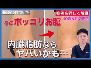 あなたは大丈夫？ポッコリお腹の原因は脂肪吸引できない「内臓脂肪」かも！？４０歳女性の症例を詳しく解説！｜vol.333【ボディデザインTV】