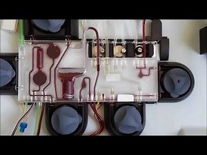 GRANULOCYTE COLLECTION BY APHERESIS MACHINE