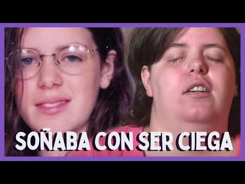 Trastorno de Identidad de Integridad Corporal (BIID)