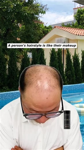 Hair_xinxin on Instagram: "❓ Does your hairline fade under office lights or on video calls? ✨ Professional-grade features for flawless presence: ✅ HD Camera Proof – No chalky finish, blends seamlessly even in 4K. ✅ Sweat & Humidity Resistant – Confidence that lasts from morning meeting to evening event. ✅ Precision Applicator – Target temples, crown, or parting with control. ✅ Safe for All Hair Types – Gentle formula works on natural, colored, or treated hair. 👉 Upgrade your professional toolki