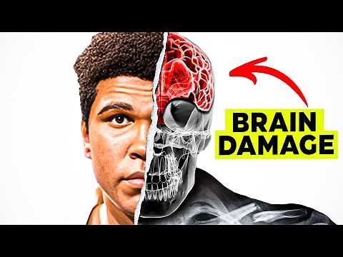 The Silent Epidemic of Brain Damage in Boxing..