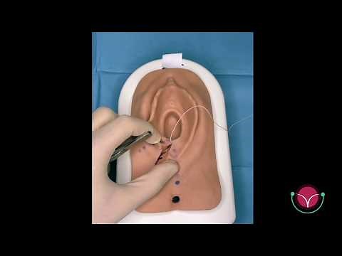 #015 - Episiotomy Surgery
