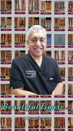 Calf Augmentation/ calf implants before & after pictures #calfimplants #beforeandafter #bodyimplants