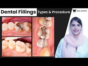 Dental Fillings: Types and Procedures Explained | Dental Aesthetics