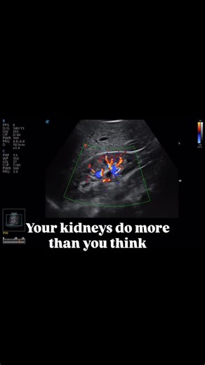 Nola Diagnostic Ultrasound on Instagram: "A kidney ultrasound may be recommended when symptoms suggest an underlying issue. Common reasons include: * Flank or lower back pain * Blood in the urine * Recurrent urinary tract infections * Difficulty or pain with urination * Abnormal kidney lab results * History of kidney stones Ultrasound is a safe, noninvasive way to evaluate kidney size, structure, stones, obstruction, and fluid buildup—without radiation. Book your kidney and bladder ultrasound to