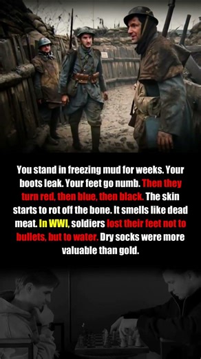 Why WWI Soldiers Lost Feet To Water