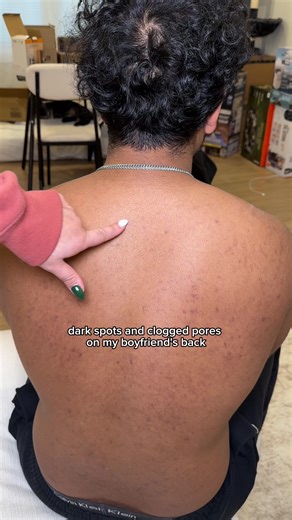 Niacinamide Benefits for Reducing Dark Spots