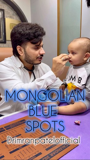 A Mongolian spot is a type of birthmark that appears as a flat, blue-grey or blue-black mark on the skin. These spots are commonly found on the lower back or buttocks but can appear elsewhere on the body. They are most prevalent in infants of Asian, African, Native American, and Hispanic descent. Mongolian spots are typically harmless and usually fade on their own by the time the child reaches school age. They are caused by pigment-producing cells (melanocytes) that get trapped in the deeper lay