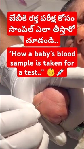 Collecting baby blood sample 💉 🤒 for testing| jaundice | infection | Dr N Pratheep Sharma