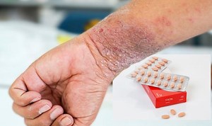 Statins: How the drug prevents heart attacks and strokes