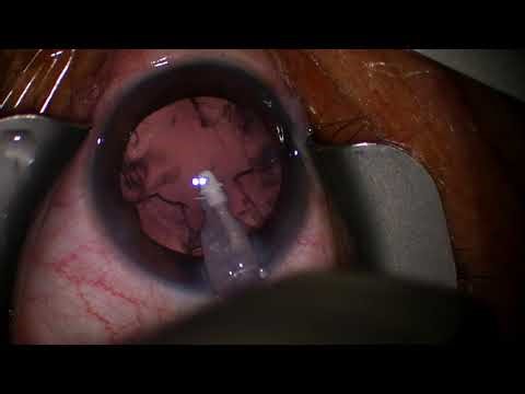 2026 01 13 151248 panoptix pro