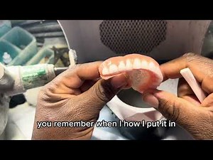 Watch what happens when I drop a dirty denture into this ultrasonic cleaner…”