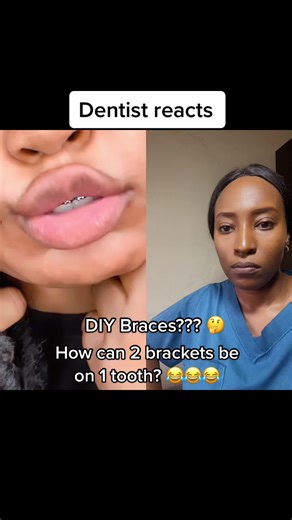 Dentist Reacts to DIY Braces: Fashion Braces Mistakes